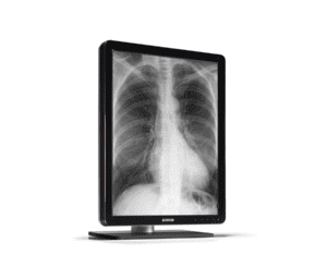 Barco Coronis 3MP LED (MDCG-3221) Diagnostic Display