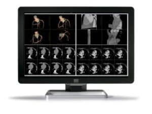 Barco Coronis Fusion 6MP LED MDCC-6430 Diagnostic Display