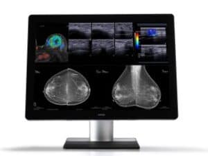 Barco Coronis Uniti (MDMC-12133) Mammography Display
