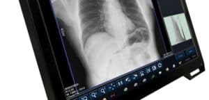 DELWorks E-Series DR System